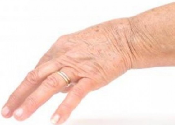 Руки выдают возраст женщины